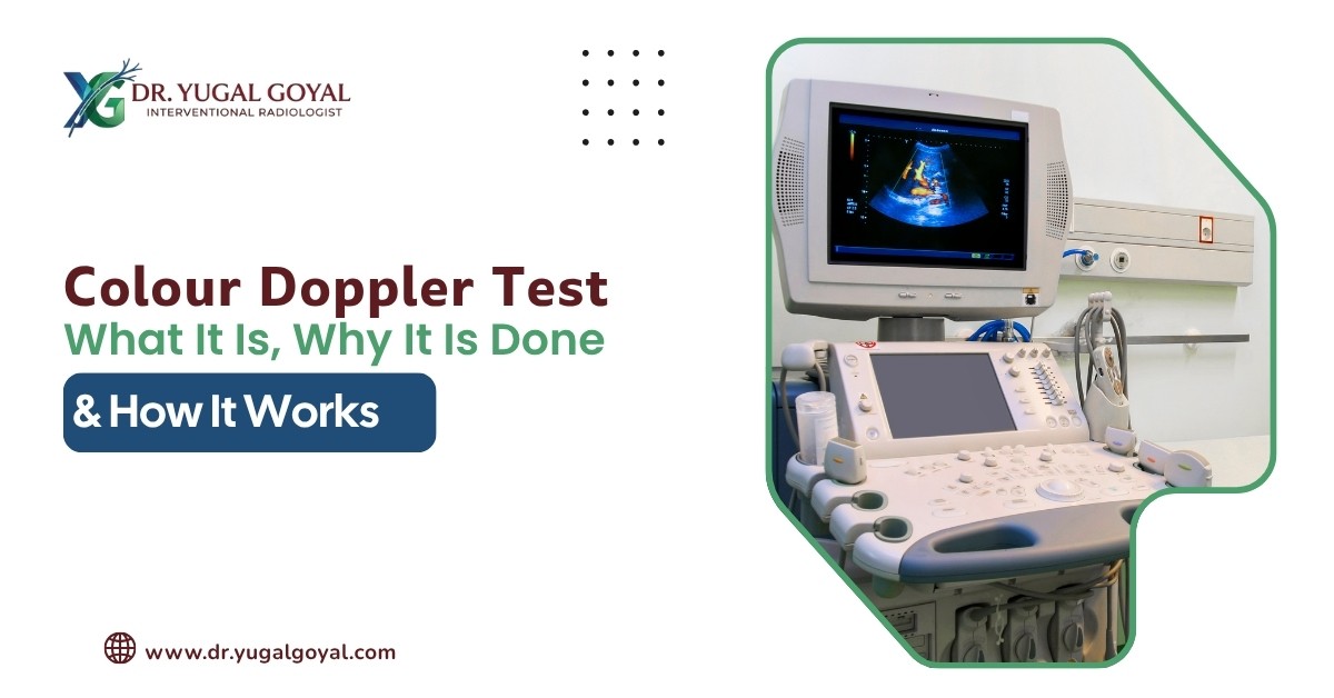 Colour Doppler Test: What It Is, Why It Is Done and How It Works