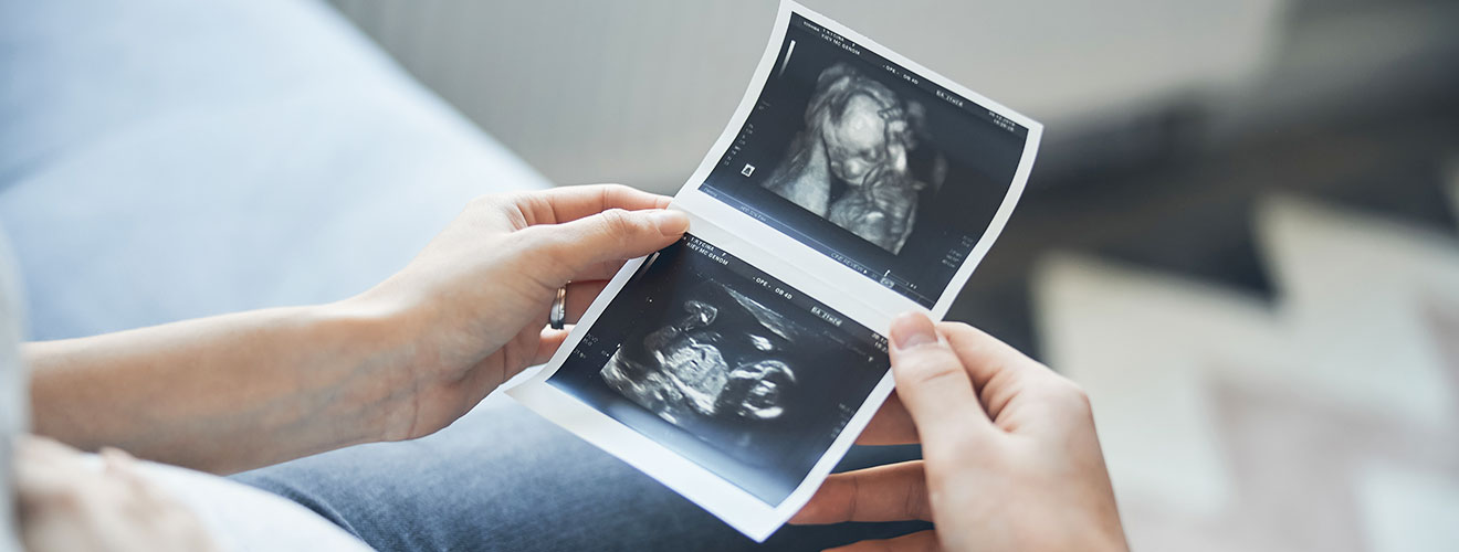 Pregnancy Scan in Siliguri: Advanced Ultrasound & Anomaly Scan