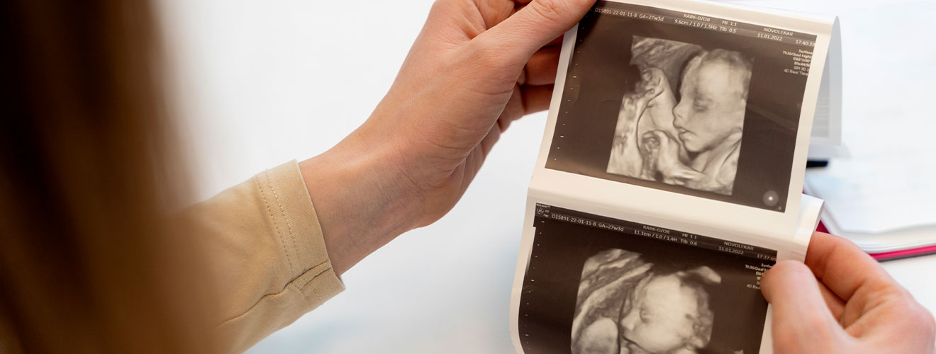 Monitoring Your Baby’s Growth and Development with Pregnancy Ultrasound in Siliguri