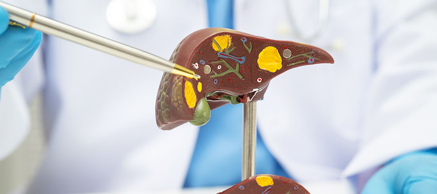 Benign liver tumors