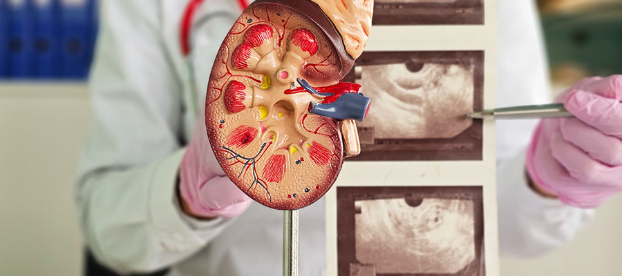 Changes in kidney size and structure