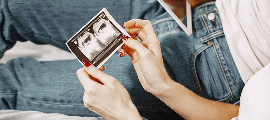 Dating scan(6-10 weeks)