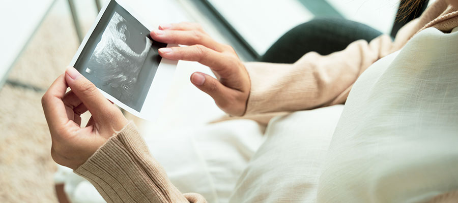 Early pregnancy scan(6-8 weeks)