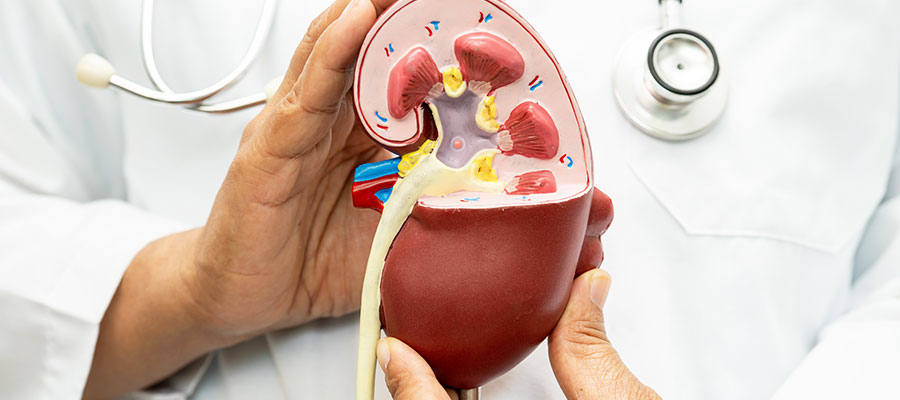 Hydronephrosis and urinary obstruction