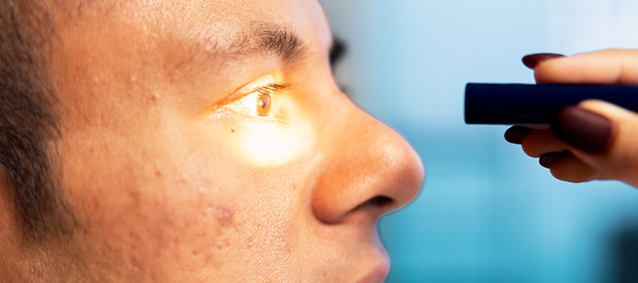 Jaundice
