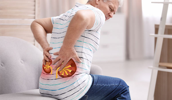 Kidney stones