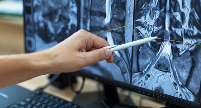 Teleradiology Service