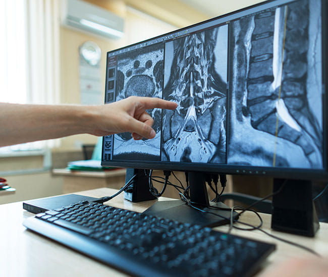 Teleradiology Services
