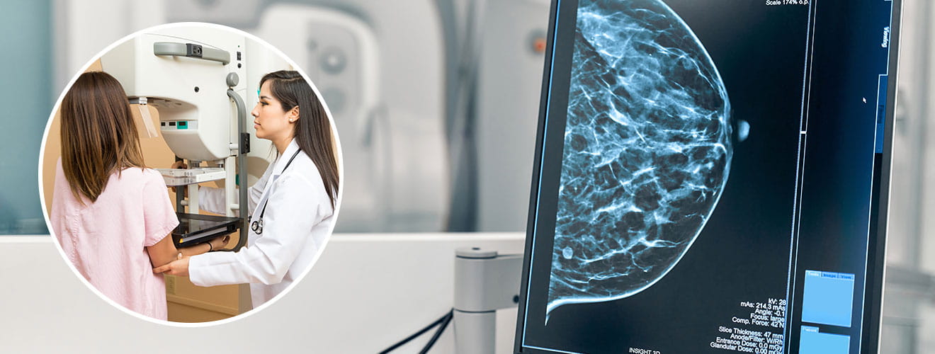 X-Ray & Breast Imaging