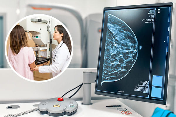 X-Ray & Breast Imaging