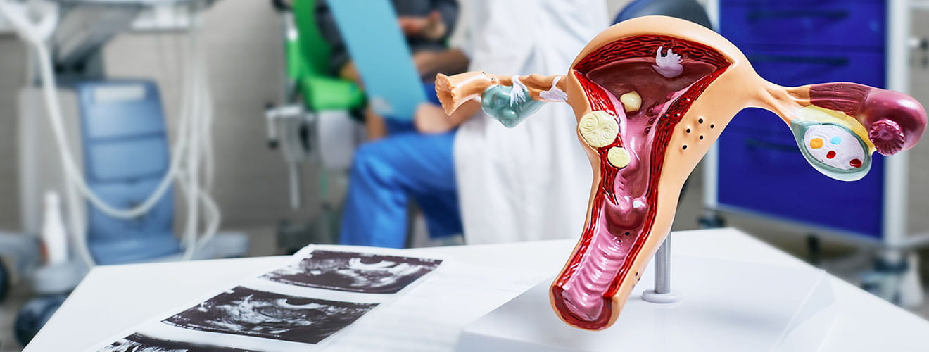 Women's Health Interventions