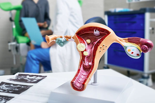 Women's Health Interventions