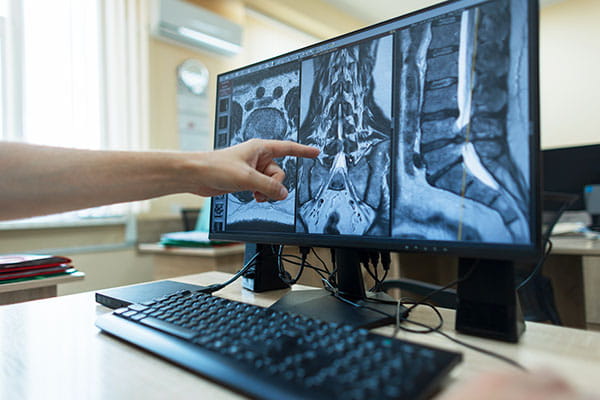 Teleradiology